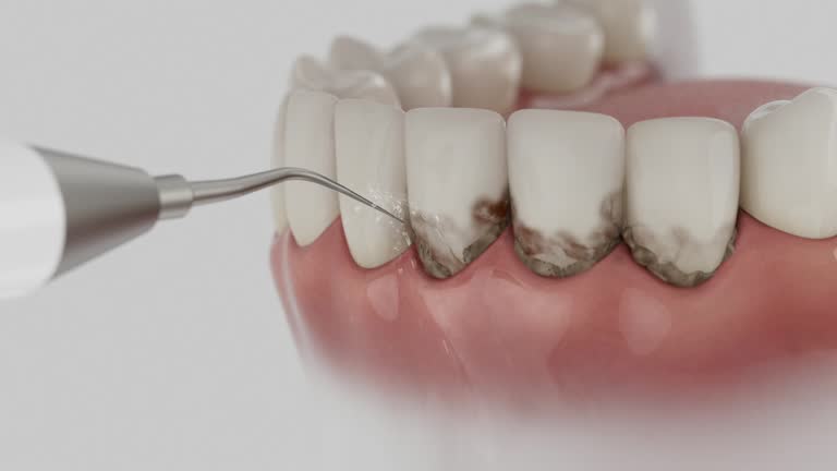 Trusted Wisdom Tooth Removal service in Littlestown, PA - Dentist Open Now